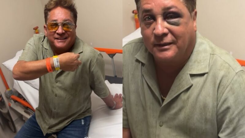 Cantor Leonardo aparece com olho roxo após escorregar de canoa durante pescaria no Pantanal