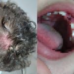 Menino chega em casa sem dente, com lesões pelo corpo e mãe acredita em maus-tratos na creche