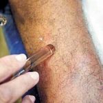 Várzea Grande registra surto de hanseníase em 29 pessoas; 14 são crianças