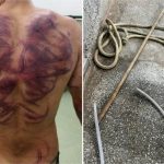 Homem tem as costas retalhadas em ‘salve’ do Comando Vermelho em VG