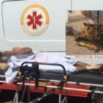 Homem tem 90% do corpo queimado ao incendiar colchão enquanto acendia cigarro