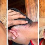 Mãe de menor agredido por PMs registra boletim de ocorrência e expõe hematomas