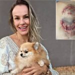 Atacada por tubarão em Fernanda de Noronha, turista de MT fala sobre o incidente