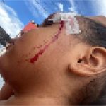 Mãe é presa acusada de atirar cabo de vassoura e causar corte profundo na cabeça da filha de 3 anos