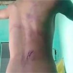 Menino de 13 anos é brutalmente agredido pelo pai em Cuiabá