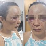 Mãe de adolescente jogada em poço teve rosto desfigurado durante espancamento