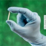 Implanon será oferecido pelo SUS: Veja como funciona e saiba tudo sobre o anticoncepcional gratuito