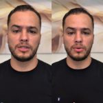 Delegado quebra silêncio, defende prisão de médico e rebate acusações de abuso; vídeo