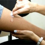 Atenção! Monitoramento aponta explosão de casos de hanseníase em MT