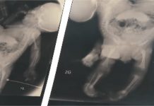 Gêmeos siameses de casal em MT devem ser separados em um ano