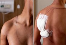 Jovem atingido por raio em ato em Brasília recebe alta após três dias internado