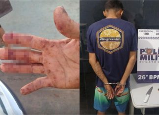 Homem tem os dedos cortados ao defender amiga de roubo em MT