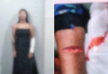 Mulher é presa em Cuiabá após ferir filho com navalha e tentar suicídio