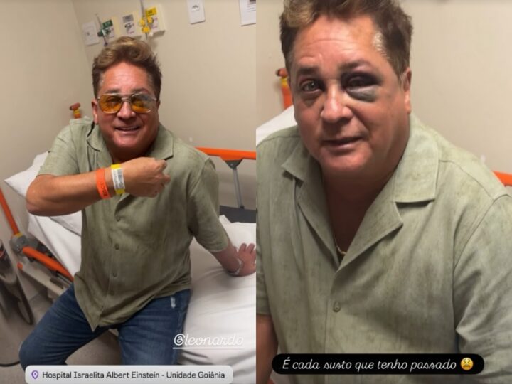 Cantor Leonardo aparece com olho roxo após escorregar de canoa durante pescaria no Pantanal