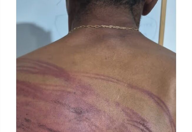 Faccionados torturam homem com mangueira e tentam degolá-lo em MT