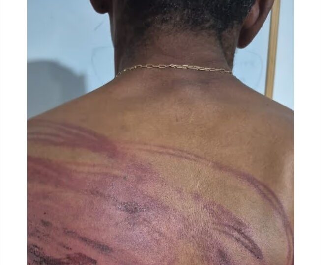 Faccionados torturam homem com mangueira e tentam degolá-lo em MT
