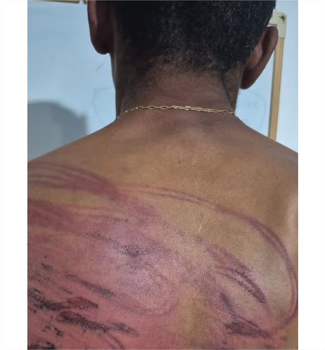 Faccionados torturam homem com mangueira e tentam degolá-lo em MT
