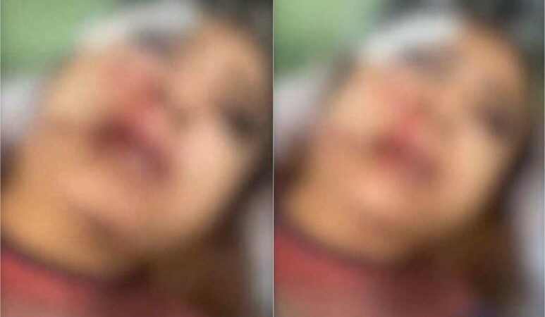 Homem é indiciado por tentativa de feminicídio após desfigurar rosto de garota de programa em VG