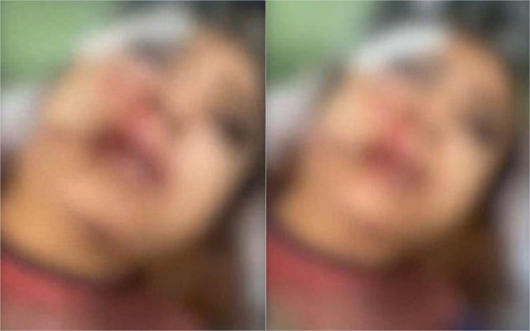 Homem é indiciado por tentativa de feminicídio após desfigurar rosto de garota de programa em VG