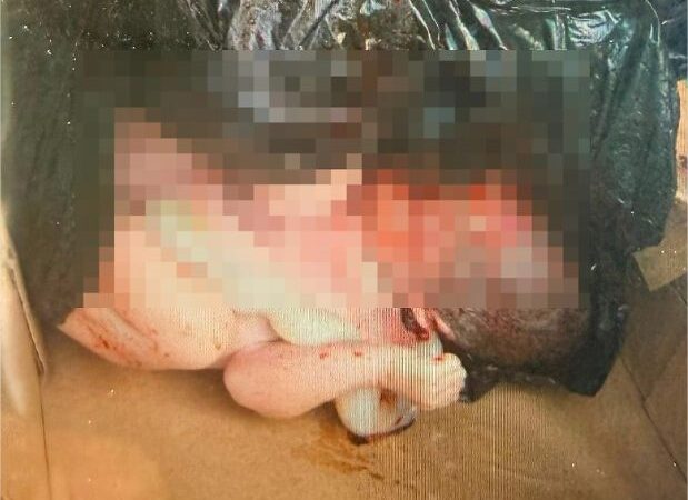 Bebê encontrado morto em lixeira de condomínio em VG tinha quase 8 meses, diz delegado