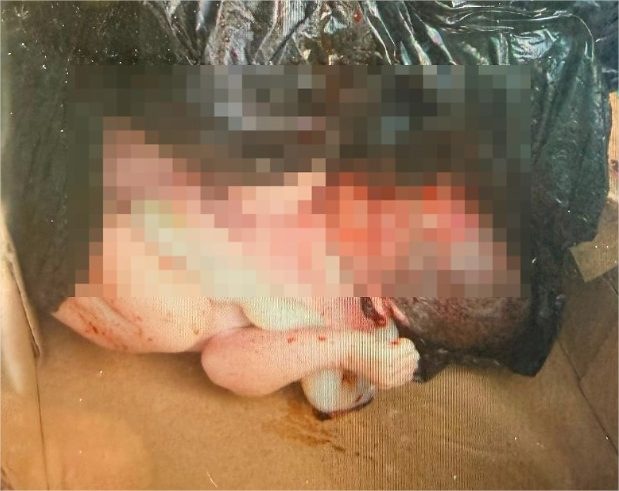 Bebê encontrado morto em lixeira de condomínio em VG tinha quase 8 meses, diz delegado