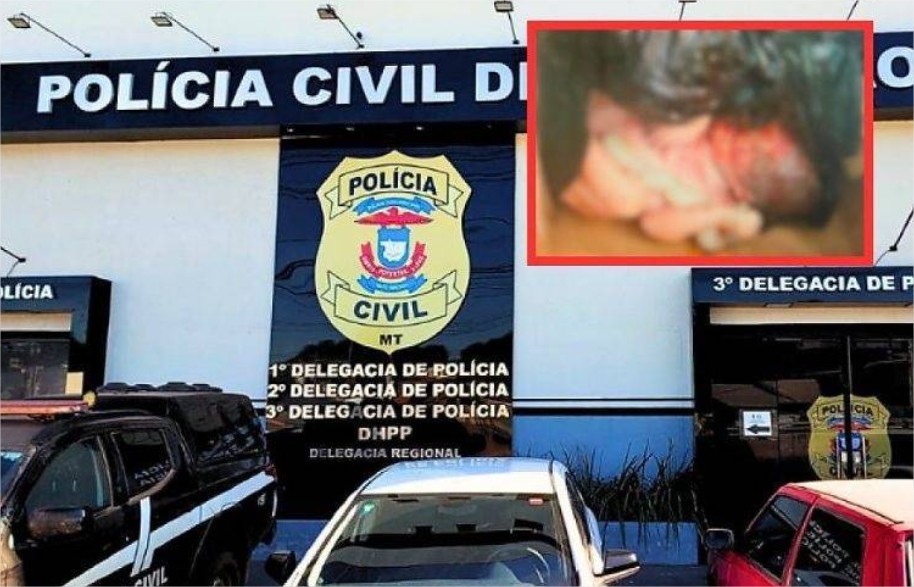 Polícia vai fazer exame de DNA e ver câmeras de segurança para identificar quem é a mãe e quem deixou corpo de criança na lixeira