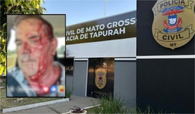 Ex-prefeito leva garrafada na cabeça durante confusão em restaurante